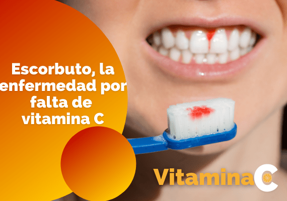enfermedad por falta de vitamina C